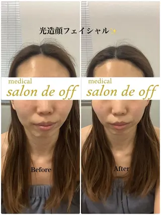 🩵Tatsumi Kana🩵のエステ・リラクイメージ