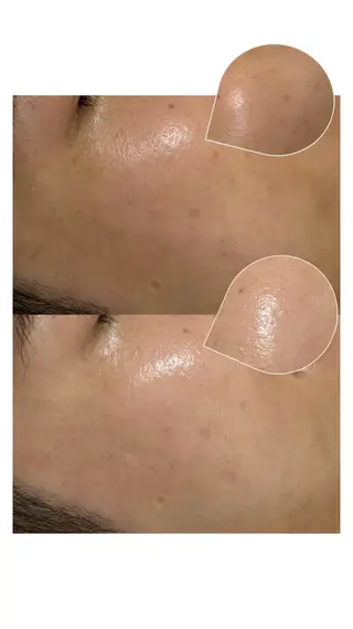 女性専門お顔剃り sunraineのエステ・リラクイメージ