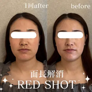 美肌salon GRAN CUORE所属・Natsuki🌙 GRAN CUOREのエステ・リラクイメージ