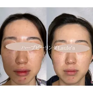 美腸サロン🌺 腸もみ/小顔/リンパのエステ・リラクイメージ