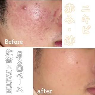 都度払い肌改善専門店 店長二上文香のエステ・リラクイメージ