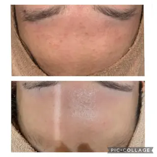 🌈Linora byRAYVIS🌈のエステ・リラクイメージ