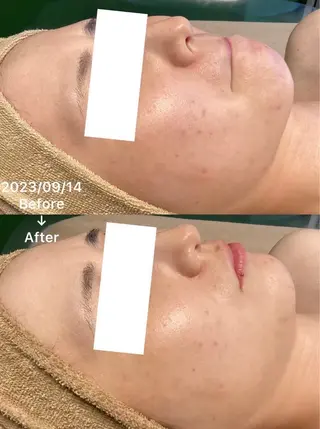 小顔・ツルツル素肌 ハリステリアのエステ・リラクイメージ