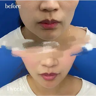 ネイル aliaハイフ&水光ジェットサロン所属・aliaハーブ水光店 エステティシャン募集のエステ・リラクイメージ