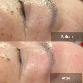 産毛専門店 Bittoのエステ・リラクイメージ