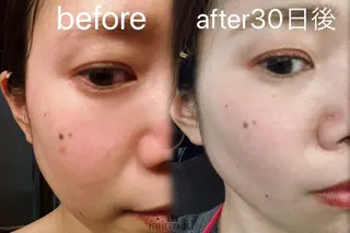 メナード熊本 嘉島のエステ・リラクイメージ