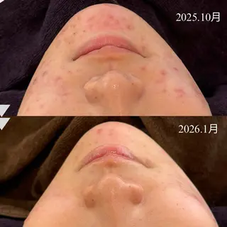 écla【中崎町】 yukikoのエステ・リラクイメージ