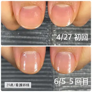 ネイル 奥園 良恵のネイルデザイン