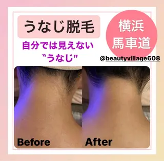 脱毛専門店《横浜•馬車道店》肌質改善所属・【都度払い脱毛 美肌脱毛】馬車道店のエステ・リラクイメージ