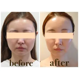 Cream 福井のエステ・リラクイメージ