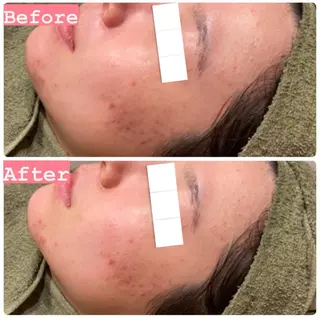 ハーブピーリング専門 muro.のエステ・リラクイメージ