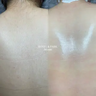 HOTEL&PARK . ワックス脱毛のエステ・リラクイメージ