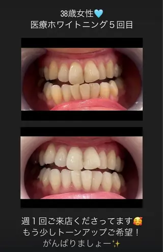 Kaula所属・Kaula ホワイトニング耳ツボのエステ・リラクイメージ