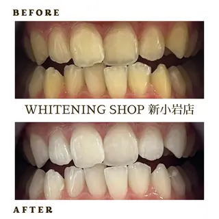 メンズ ホワイトニング ショップ新小岩店のその他イメージ