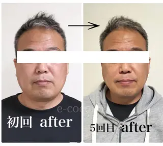 小顔と ヘッドスパのお店のエステ・リラクイメージ