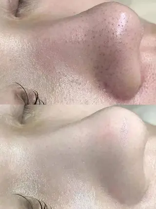 Queen Salonのエステ・リラクイメージ