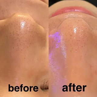 メンズ 🔥メンズ特化🔥 兵藤　太樹の眉毛・アイブロウイメージ