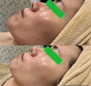 小顔&美肌品川店 Masqueradeのエステ・リラクイメージ