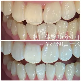 PLATINUM Beauty 横浜店所属・ホワイトニングルーム 横浜店のその他イメージ