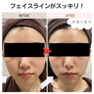 メンズ ✨美肌＆痩身エステ✨ be feel千葉店のエステ・リラクイメージ