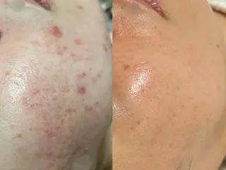 フェイシャルサロン シーラックス　河村のエステ・リラクイメージ