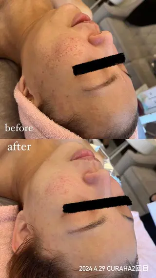 BLESS BEAUTYのエステ・リラクイメージ