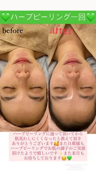 メンズ Salon de Lino 御器所のエステ・リラクイメージ