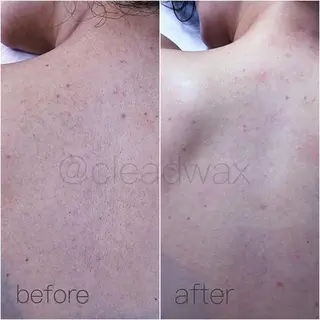 CLEAD赤坂見附店 坂田のエステ・リラクイメージ