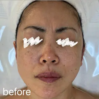 肌質改善|天王寺 For...はるかのエステ・リラクイメージ