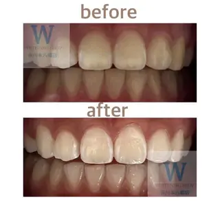 メンズ ホワイトニング ショップ本八幡店のエステ・リラクイメージ