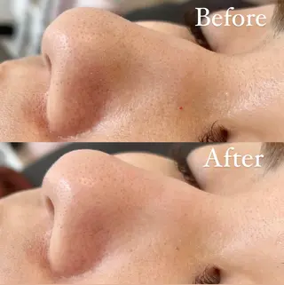 吉村 真樹のマツエク・マツパデザイン