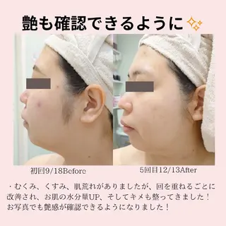 PRETTIEST SHINE所属・フェイシャル/ボディ /ブライダル山田浩子のエステ・リラクイメージ