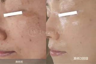 Hare&所属・川西エステサロン Hare&のエステ・リラクイメージ