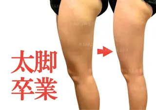本気のリンパ痩身 ♦︎ラナンスパのエステ・リラクイメージ