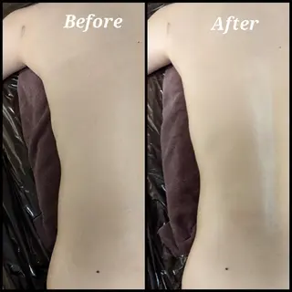 整体エステ　NEW ME所属・深層リンパオイル/小 顔とドライヘッドスパのエステ・リラクイメージ