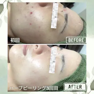 バスト美肌小顔専門 Mimpi【ミンピ】のエステ・リラクイメージ