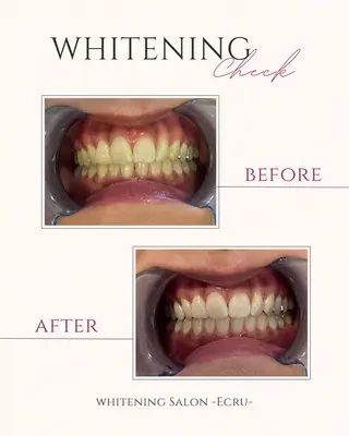 ホワイトニングサロン Ecru所属・ホワイトニングサロン Ecru エクリュのその他イメージ