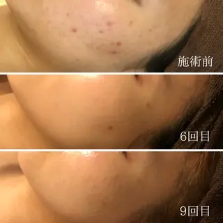 痩身専門サロン ビューティーグランツのエステ・リラクイメージ