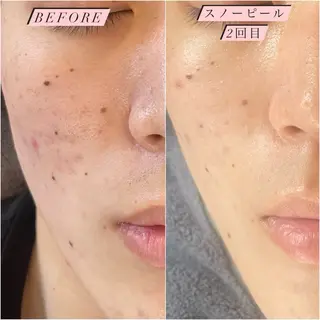 フィユ所属・〚博多〛フィユ 水江のマツエク・マツパデザイン