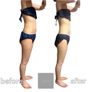 marron所属・痩身ハイパーナイフ ララピールリアボーテのエステ・リラクイメージ