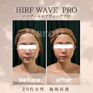 小顔サロン Marottのエステ・リラクイメージ