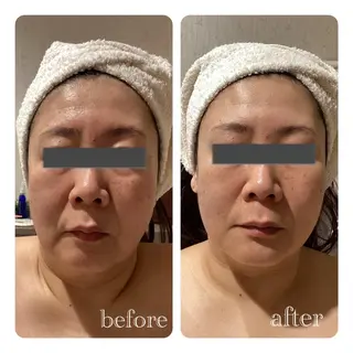 痩身脱毛専門店 Partirのエステ・リラクイメージ