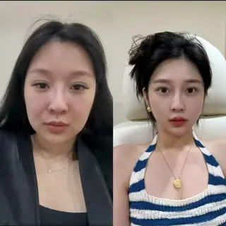 マツエク・マツパ aliaハイフ&水光ジェットサロン所属・aliaハーブ水光店 エステティシャン募集のエステ・リラクイメージ