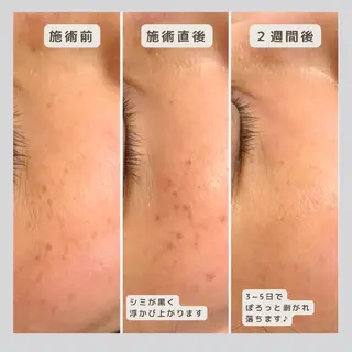 シミケア専門店 HAQUAのその他イメージ