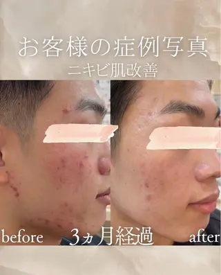 メンズ cpsalon ÉTOILE横浜馬車道店所属・ÉTOILE NATSUMIのエステ・リラクイメージ