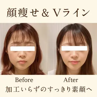 【歴13年】劇的小顔 D rマジックタッチのエステ・リラクイメージ