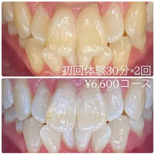 PLATINUM Beauty 横浜店所属・ホワイトニングルーム 横浜店のその他イメージ