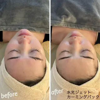 うなじ脱毛/美肌脱毛 LABELのエステ・リラクイメージ