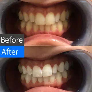 セミロング カラー パーマ ヘアアレンジ メンズ アイブロウ マツエク・マツパ ネイル キッズ 中目黒 ホワイトニングサロンのその他イメージ