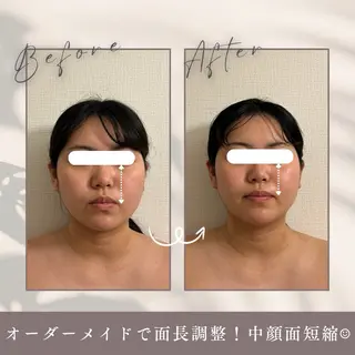 小顔セラピーLIL所属・小顔セラピー LILのエステ・リラクイメージ